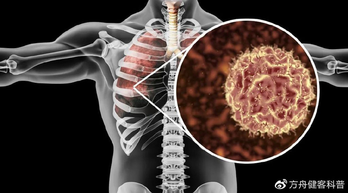 肺癌已成我国肿瘤发病率和死亡率第一疾病，确诊后能活多久？-腾渊科技论坛