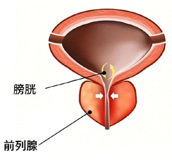 这种癌症,偏爱 “男同胞”!速查你是不是 “高危人群”→-腾渊科技论坛